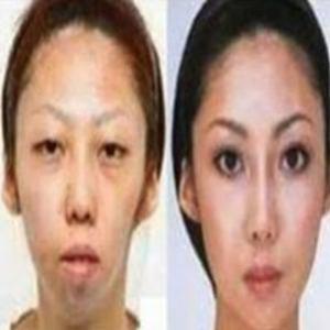 Chinês processa esposa que fez plástica para ficar 'bonita'