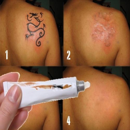 Criado creme para remover tatuagem sem dor e barato