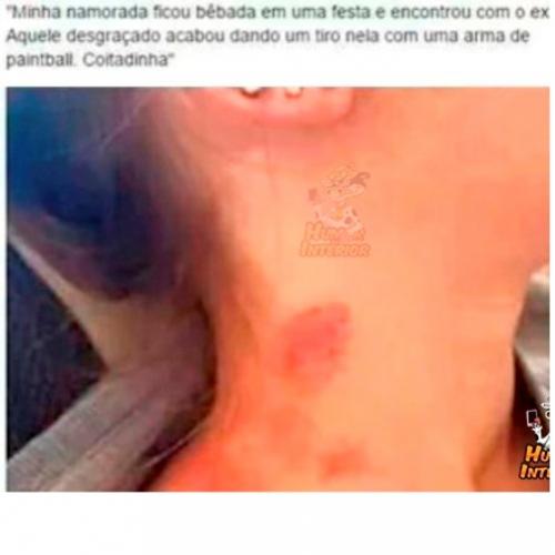 O ex da minha namorada deu um tiro nela com uma arma de paintball