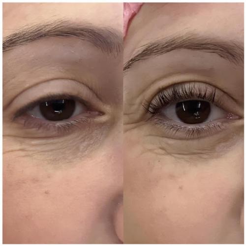 LASH LIFTING