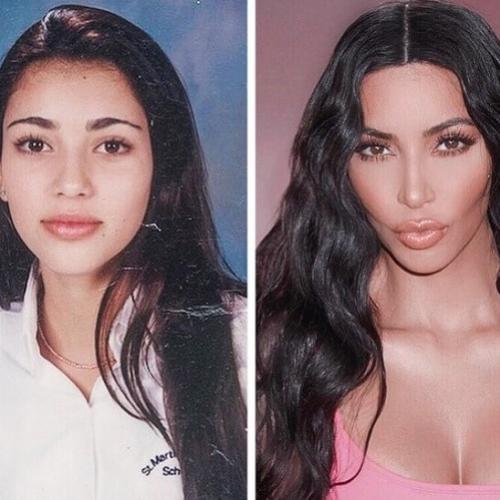 10 celebridades que eram mais bonitas antes de fazer cirurgia plástica