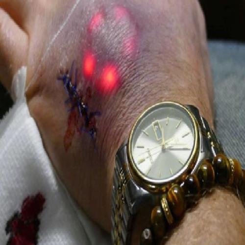 Primeiro brasileiro a implantar biochip na pele
