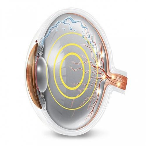 Vem aí novidades para tratar e diagnosticar o glaucoma