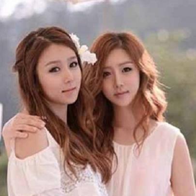 A incrível transformação das irmãs gêmeas sul-coreanas após cirurgia p