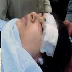 Malala Yousufzai já consegue ficar de pé após atentado