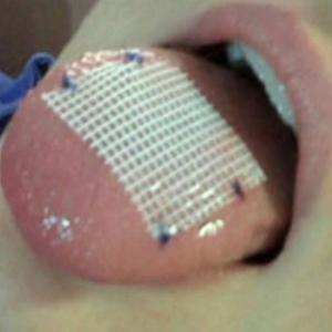 Mulheres costuram a língua para emagrecer!