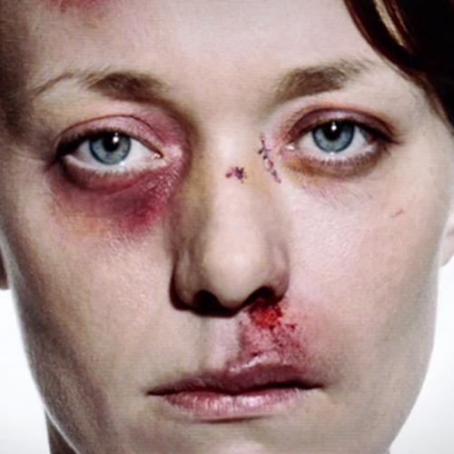Não feche seus olhos à violência doméstica