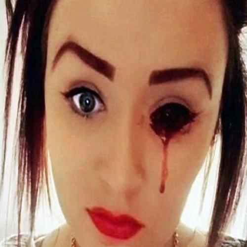 Garota sofre com mistério que faz sangrar seus olhos, ouvidos, cabeça 