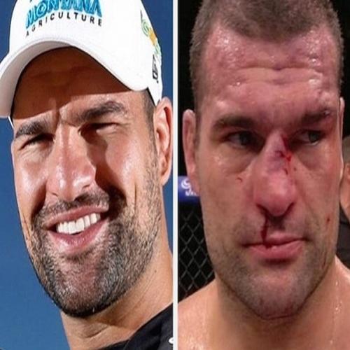 14 lutadores do UFC que ficaram desfigurados após suas lutas