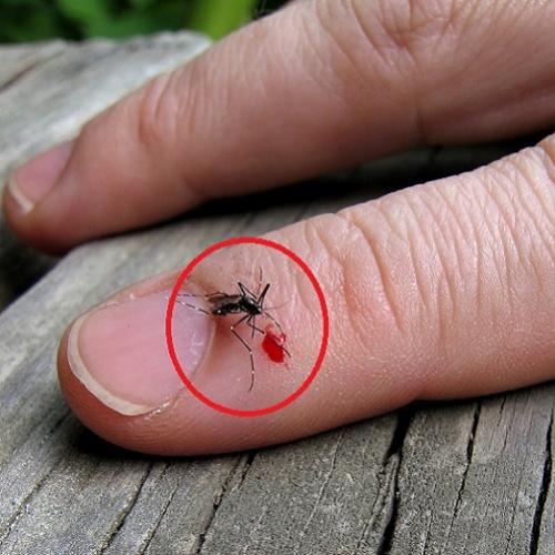 Por que a picada de um mosquito dói e coça?, Saiba como evitar isso ag