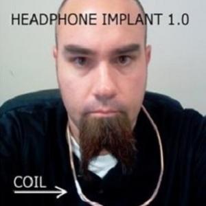 Homem implanta headphone na orelha