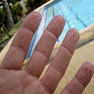 Porque ao ficarmos muito tempo na água os dedos se enrugam?