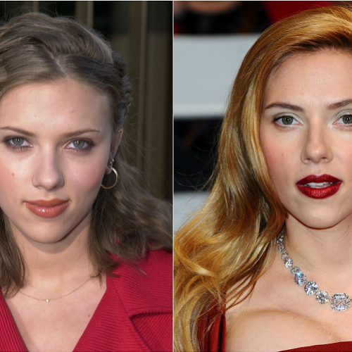 O antes e o depois das celebridades de Hollywood