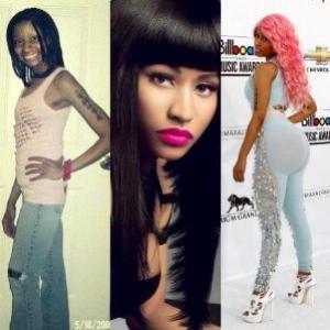 Antes e depois da fama: Nicki Minaj e suas cirurgias plásticas.