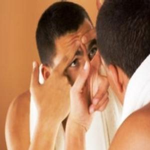 A herança maldita da acne: como tratar manchas e cicatrizes
