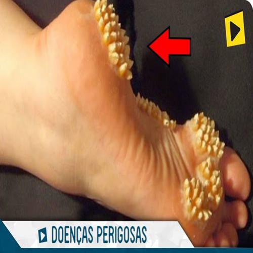 Top 5 Doenças Mais Perigosas do Mundo!!