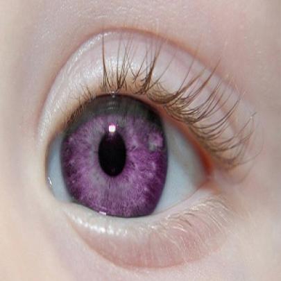 É possível nascer com os olhos da cor violeta? 