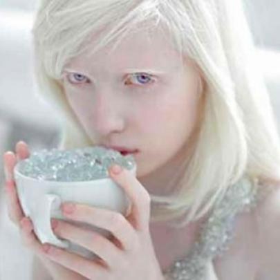 Apresento-lhes Nastya Zhidkova, a albina mais linda do mundo!