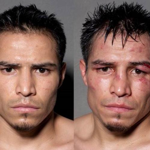  12 fotos de boxeadores antes e depois da luta