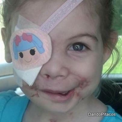Menina com rosto operado após ataque de pitbull é expulsa de restauran