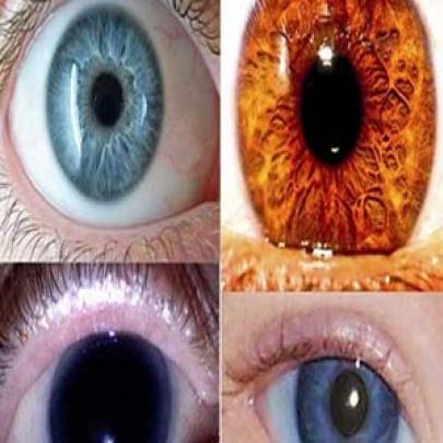 Conheça as cores de olhos mais raras do mundo!