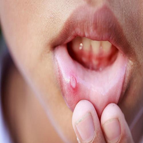 8 sinais na sua boca e o que eles dizem sobre sua saúde