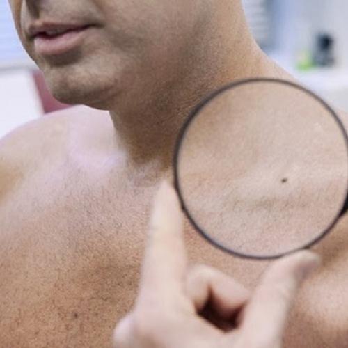 5 maneiras da pele sinalizar problemas de saúde