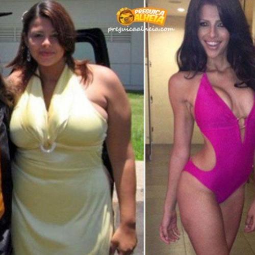 Antes e depois (gordo/magro)
