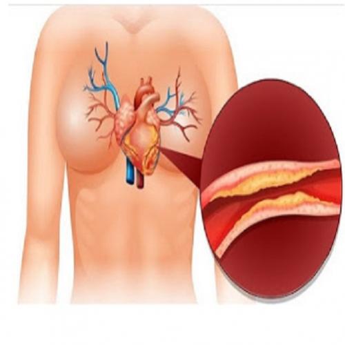 11 Dicas para baixar o colesterol ruim