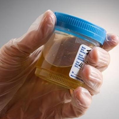 Cientistas do Reino Unido conseguem usar urina para carregar celulares