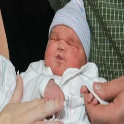 Bebê de 6,5 kg nasce nos EUA e chama atenção de médicos