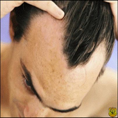 Algumas dicas caseiras para prevenir a queda de cabelo